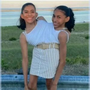 "We share v@g!na but only one of us has a boyfriend"- 22-year-old Conjoined Twin Sisters Open Up About Their Dating Lives